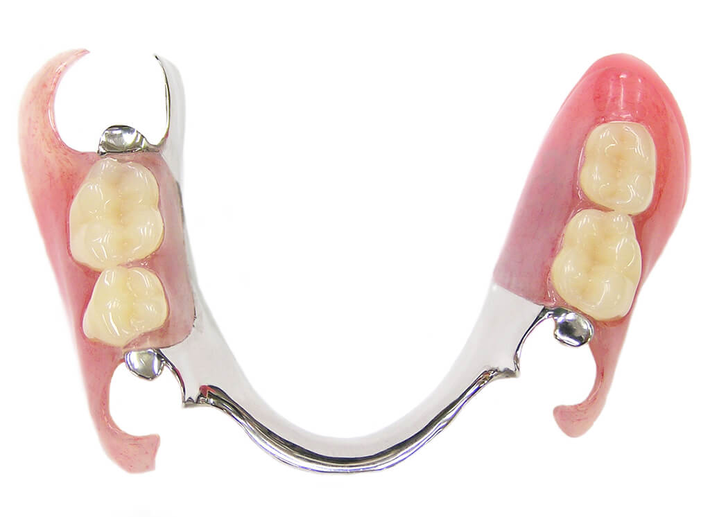 入れ歯・ブリッジとの違い